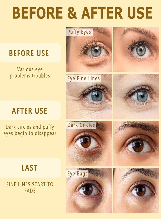 MAVENI 24K Gold Eye Mask-Under Eye Patches for Dark Circles-60 Pcs for Puffy Eyes,Anti-Aging,Bags & Wrinkles,Boost Lift & Firm the Look of the Eye Area,Hydrating, Anti-Wrinkle & Cooling - Image 5